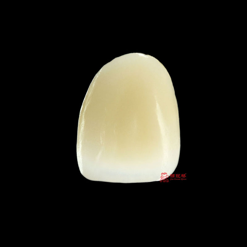 All-ceramic crowns